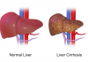 Biotime Has Licensed One Of Its Pluripotent Cell Lines To GoLiver