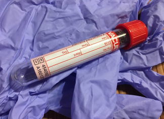Update On Commercialization Of Immunovia’s IMMray™ PanCan-d Blood-Based Diagnostic