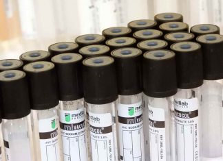 ArcherDX And Ayala Pharmaceuticals Partner To Develop CDx For Notch Activated Cancers