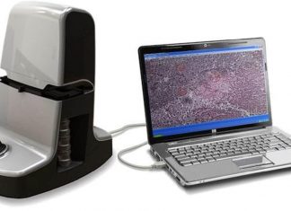 Diascopic’s AI For TB Detection Secures $225,000 Small Business Innovation Research Grant