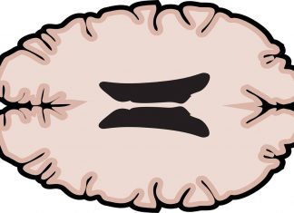 Multiple Sclerosis In Western Norway