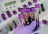 How Bias can Creep into Biobanks that Drive Precision Health and Clinical AI