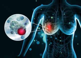 Allelica Partners with Taiwanese Biobanks to Perform Breast Cancer Polygenic Risk Score Analysis Allelica Partners with Taiwanese Biobanks to Perform Breast Cancer Polygenic Risk Score Analysis