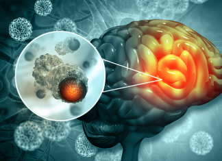 RENACER: World’s First Biobank of Brain Metastasis Living Samples RENACER: World's First Biobank of Brain Metastasis Living Samples