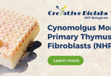 Creative Biolabs Expands NHP Primary Cell Portfolio to Accelerate Translational Neuroscience and Metabolic Research Creative Biolabs Expands NHP Primary Cell Portfolio to Accelerate Translational Neuroscience and Metabolic Research