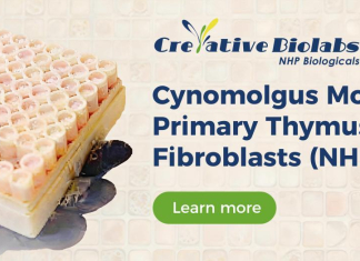 Creative Biolabs Expands NHP Primary Cell Portfolio to Accelerate Translational Neuroscience and Metabolic Research Creative Biolabs Expands NHP Primary Cell Portfolio to Accelerate Translational Neuroscience and Metabolic Research